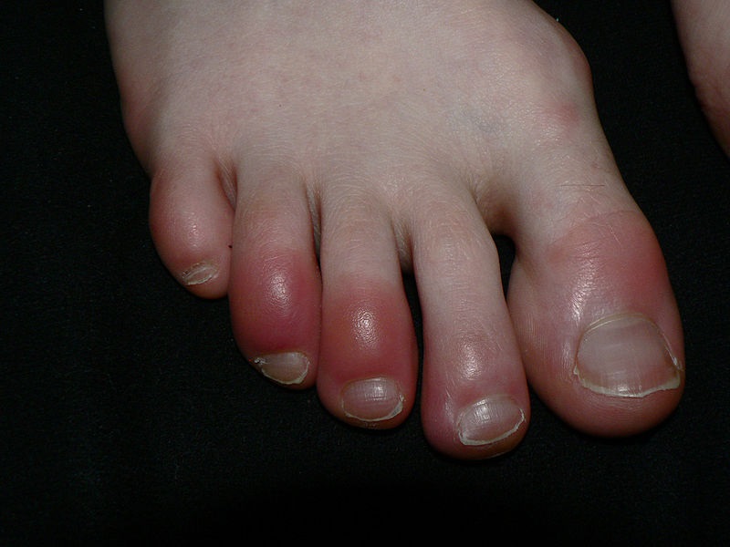 What Are The Reasons To Maintain Foot Health?
