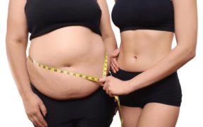 How much weight can I reduce after a gastric sleeve