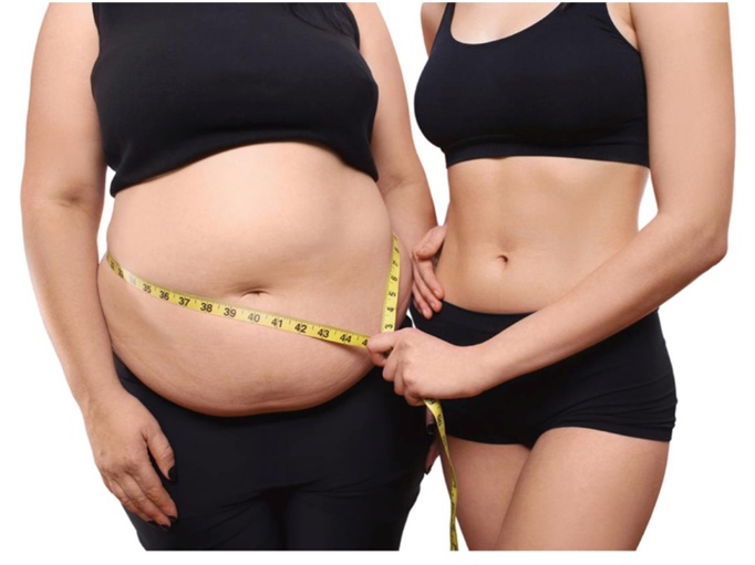 How much weight can I reduce after a gastric sleeve