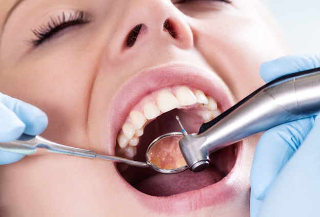 5 Most Common General Dentistry Procedures