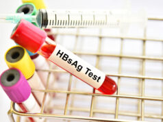 Early Detection, Prevention, and Monitoring: Why the HBsAg Test Matters