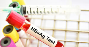 Early Detection, Prevention, and Monitoring: Why the HBsAg Test Matters