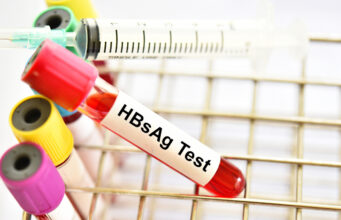 Early Detection, Prevention, and Monitoring: Why the HBsAg Test Matters
