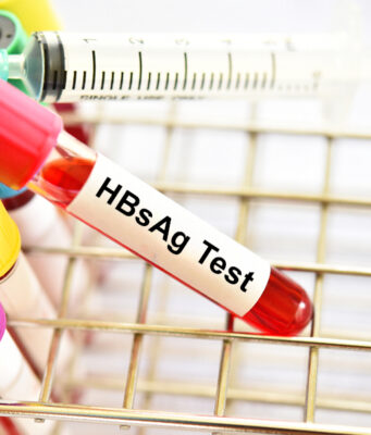 Early Detection, Prevention, and Monitoring: Why the HBsAg Test Matters