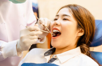 A Guide to a Brighter Smile: How to Explore Teeth Whitening Options