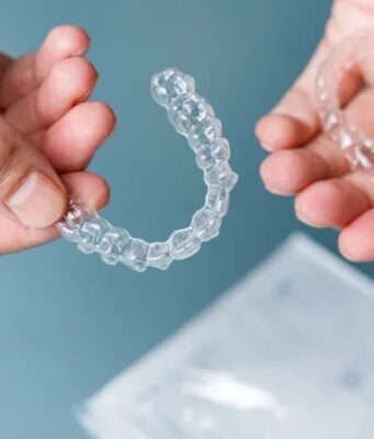 Step-by-Step Guide: How Clear Aligner Works