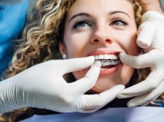 A Short Guide to Invisalign and Clear Aligner Treatment