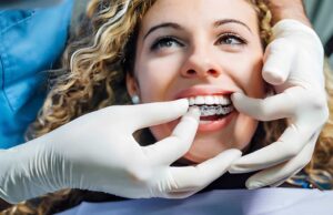 A Short Guide to Invisalign and Clear Aligner Treatment
