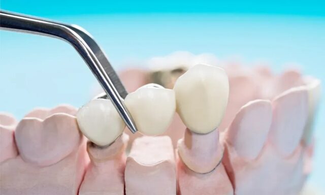 article_32488960_gallery_1776330947809