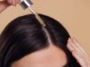 What people usually expect when starting treatment for early hair loss