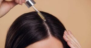 What people usually expect when starting treatment for early hair loss