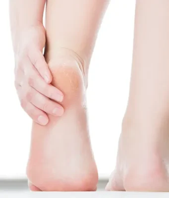 How Heel Magic Supports Healthier Looking Heels