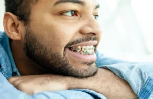Why Adult Orthodontics Is More Popular Than Ever