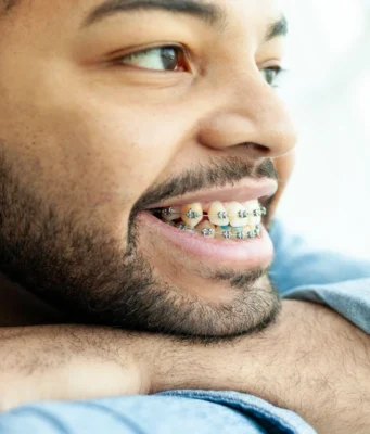 Why Adult Orthodontics Is More Popular Than Ever