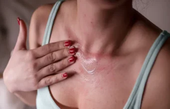 Effective Skin Stress Response Treatment for UK Residents