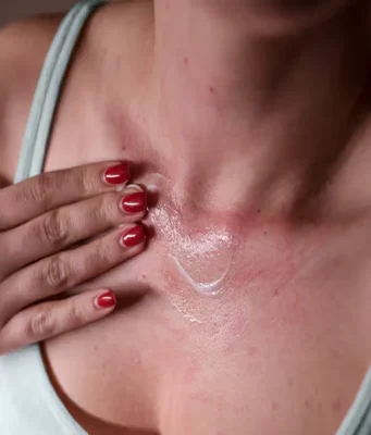 Effective Skin Stress Response Treatment for UK Residents