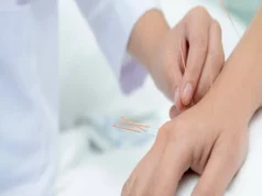 Acupuncture in New York City: Relief and Wellness Unveiled