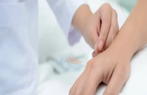 Acupuncture in New York City: Relief and Wellness Unveiled