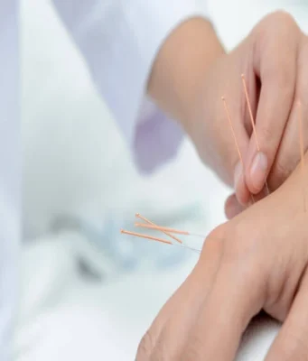 Acupuncture in New York City: Relief and Wellness Unveiled