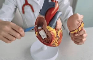 Tissue Valve Replacement or Mechanical Valve: Durability, Blood Thinners, Age and How to Decide With Your Cardiologist