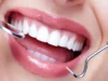 Why Some Pediatric Cavities Can Be Sealed Without Traditional Drilling