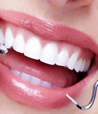 Why Some Pediatric Cavities Can Be Sealed Without Traditional Drilling