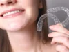 What Parents Should Know Before Choosing Invisalign for their Teen